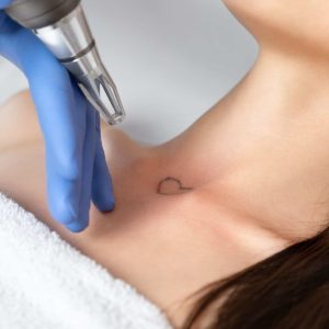 Cosmetic Tattoo and Removals 2