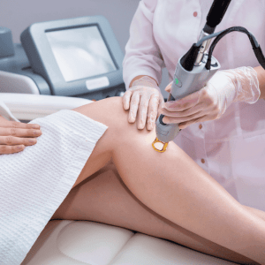 Electrolysis Permanent Hair Removal