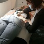 Deb performing a tattoo removal